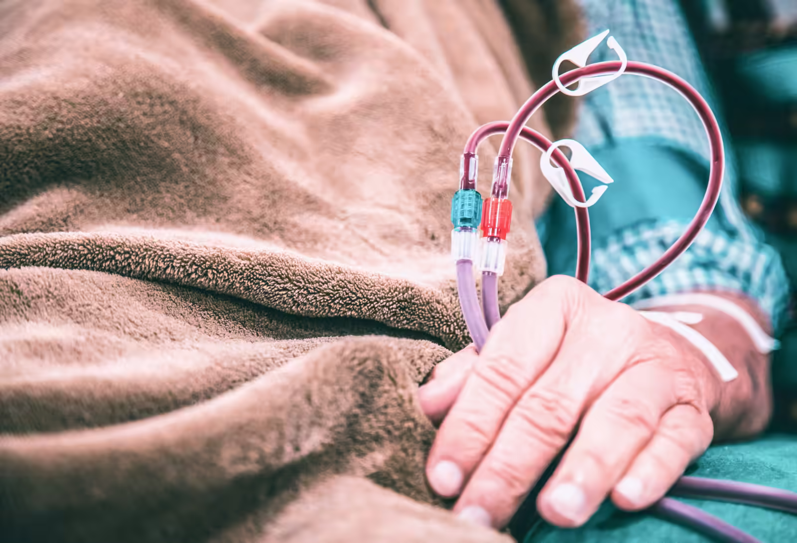 ESRD patient receiving dialysis treatment at a dialysis centre